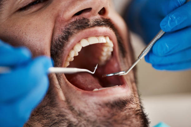 Best Dental Inlays and Onlays  in Barnsdall, OK